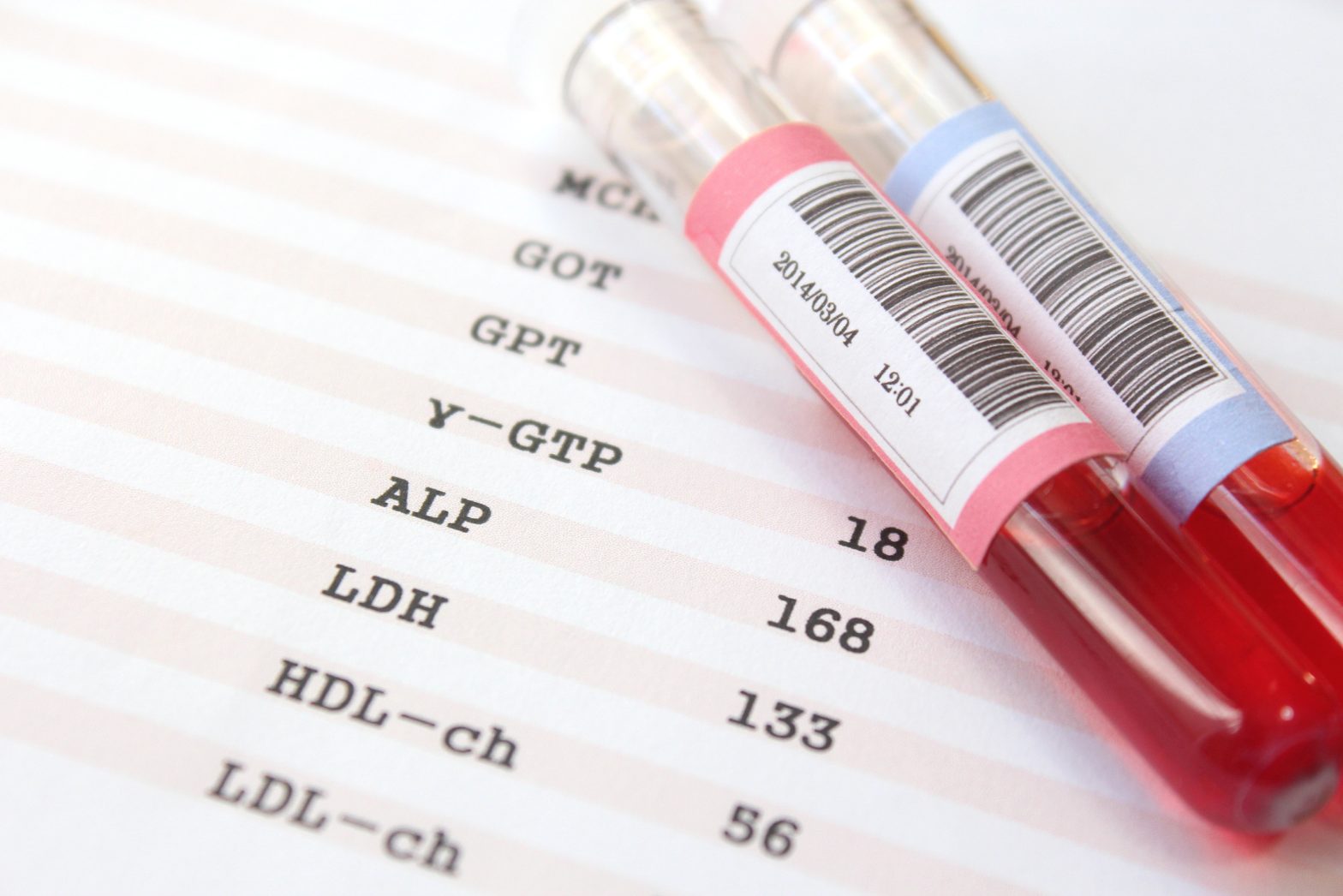 amostra de recolha de sangue para analisar o colesterol