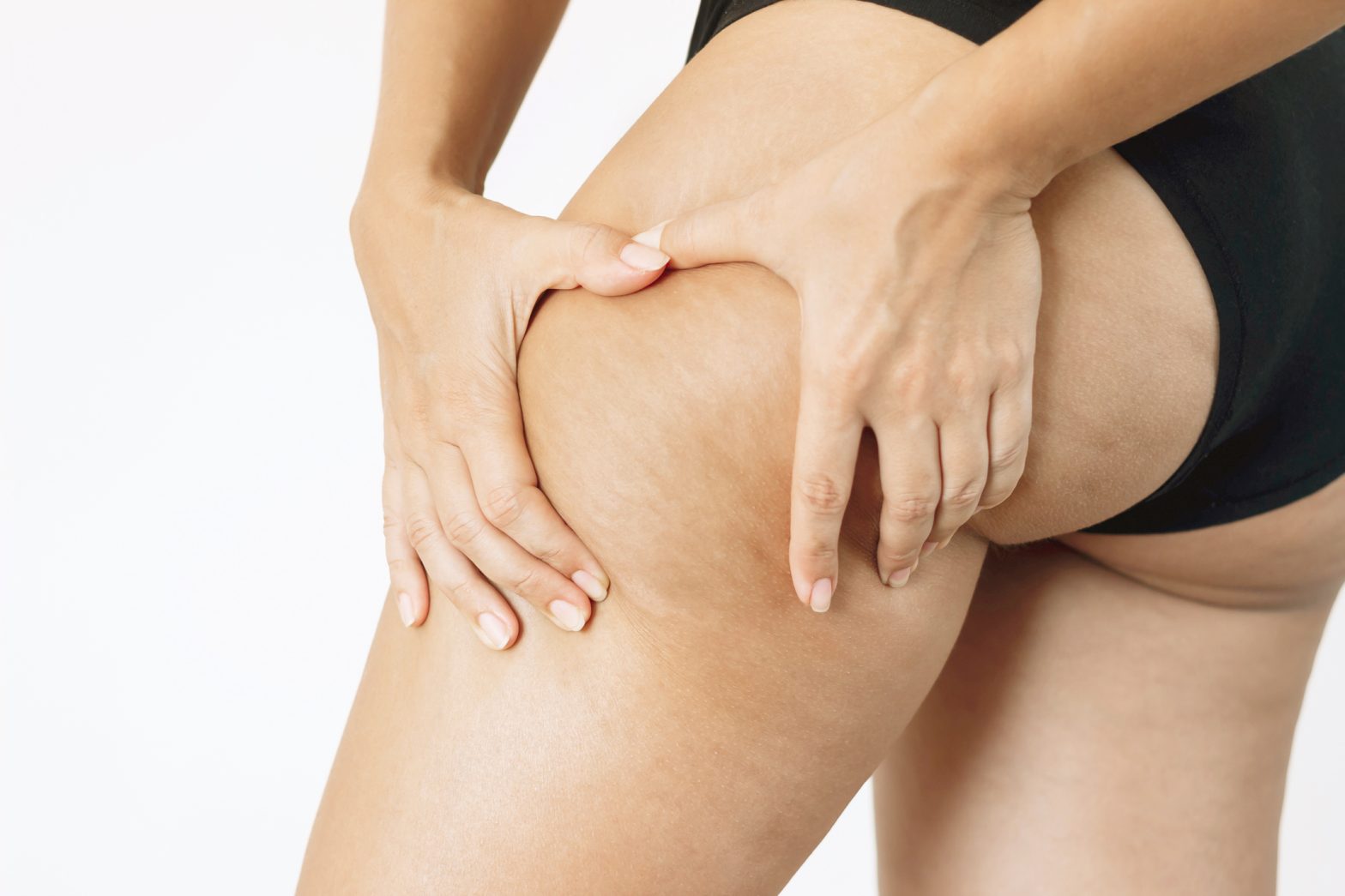 lipedema tratamento